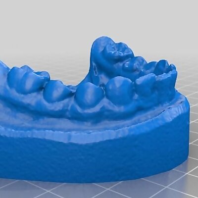 Set of teeth  dental model  3D Scan test with Raspi Cam