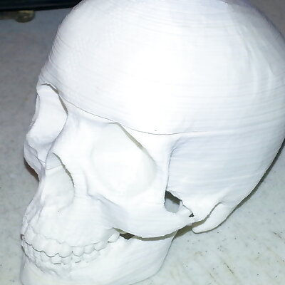 Sliced Human Skull with Mandible and Teeth