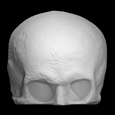 Skull Cast of Robert Burns