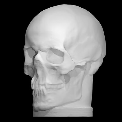 Skull cast of Dr Johann Caspar Spurzheim