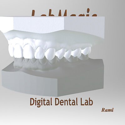 Digital Orthodontic Study Models with Virtual Bases