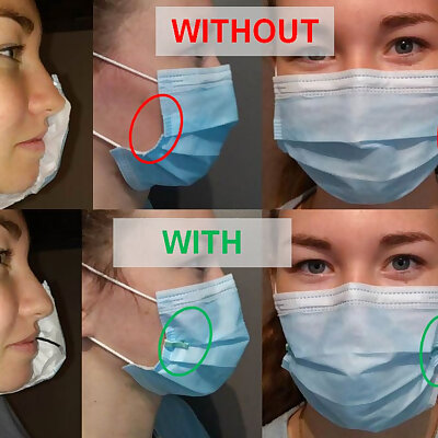 Surgical mask retractor  Ecarteur de masque chirurgical COVID19