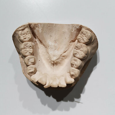 Dental model（generated by Revopoint POP 2）