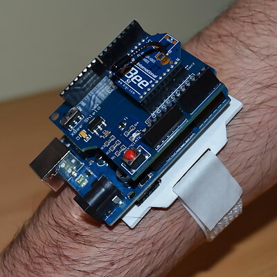 Arduino Support Forearm