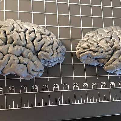 Human Brain Hemispheres from MRI data