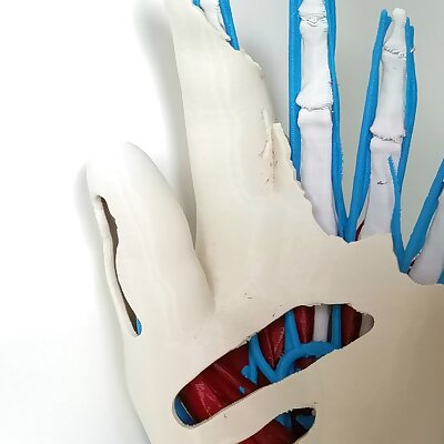 Anatomic Hand multi material